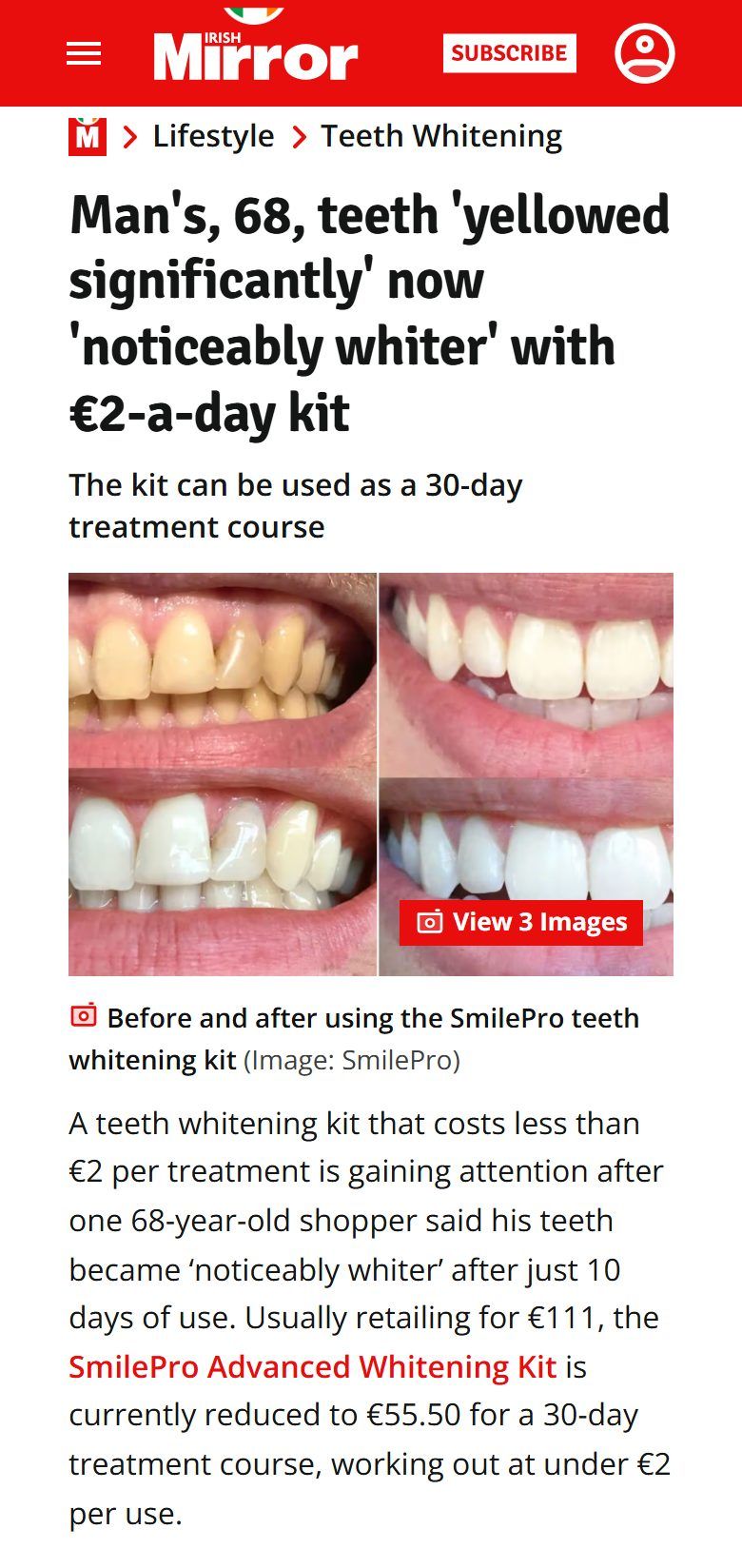 Irish Mirror: Man's, 68, teeth 'yellowed significantly' now 'noticeably whiter'